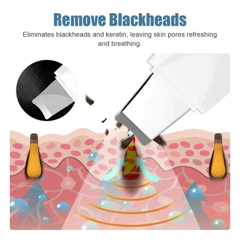Deep Vibrate Skin Scrubber Facial Cleaner Shovel Spatula Not Ultrasonic Face ScrubberPeeling Blackhead Remover Facial Ma ssager
