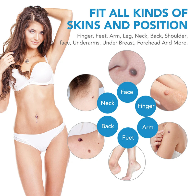 2 IN 1 Auto Micro Skin Tag Remover Device Standard And Micro Skin Tag Removal Kit Adult Mole Wart Remover Face Care Beauty Tools