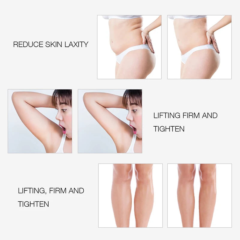 EMS & RF Radio Frequency Body Slimming Machine Fat Burner Slim Shaping Device LED Light Therapy Lose Weight Cellulite Massager