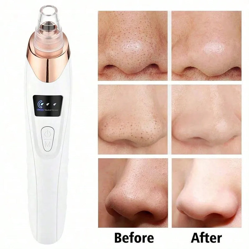 Electric Facial Skin Care Pore Removal Cleanser Vacuum Acne Removal ,Women Blackhead Remover Pore Vacuum,Facial Pore Cleaner