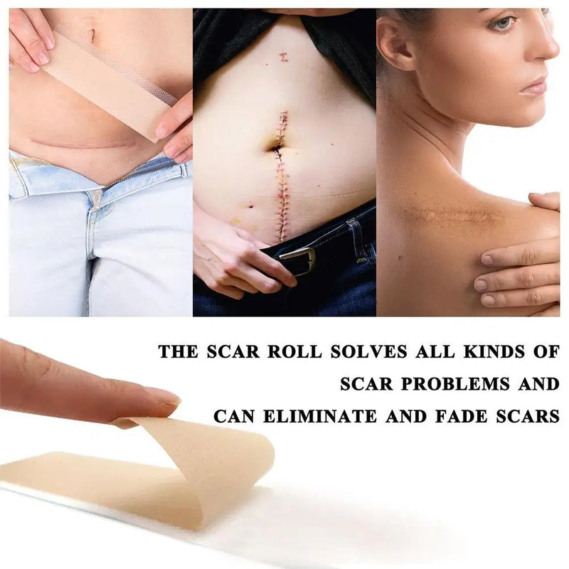 150cm Silicone Gel Scar Sheet Patch Treatment Removal Tape Acne Trauma Burn Scar Cover Skin Repair Section Ear Beauty