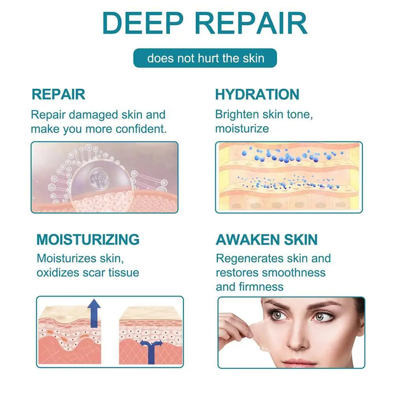 150cm Silicone Gel Scar Sheet Patch Treatment Removal Tape Acne Trauma Burn Scar Cover Skin Repair Section Ear Beauty