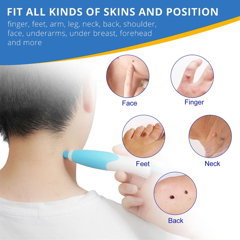 2 IN 1 Auto Micro Skin Tag Remover Device Standard And Micro Skin Tag Removal Kit Adult Mole Wart Remover Face Care Beauty Tools