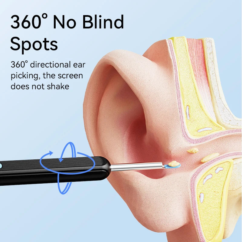 Ear Wax Removal Ear Cleaner with Camera Ears Wax Removal Kit with 1296P HD Ear Otoscope with 6 LED Lights Earwax Removal Tools
