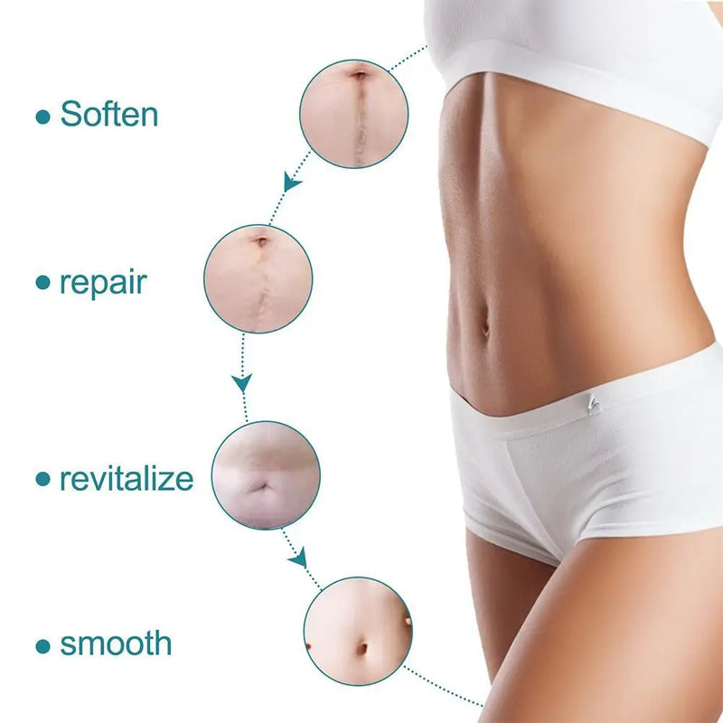 150cm Silicone Gel Scar Sheet Patch Treatment Removal Tape Acne Trauma Burn Scar Cover Skin Repair Section Ear Beauty