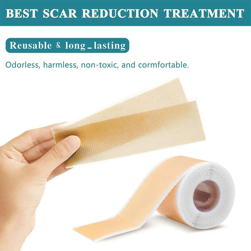 150cm Silicone Gel Scar Sheet Patch Treatment Removal Tape Acne Trauma Burn Scar Cover Skin Repair Section Ear Beauty