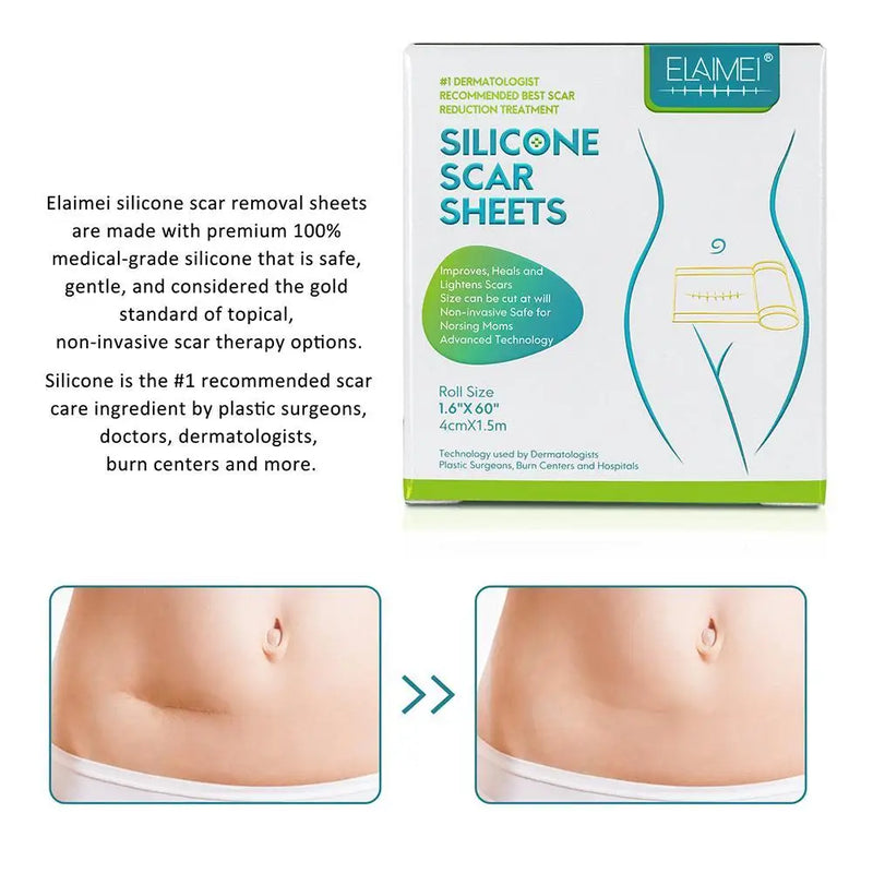 150cm Silicone Gel Scar Sheet Patch Treatment Removal Tape Acne Trauma Burn Scar Cover Skin Repair Section Ear Beauty