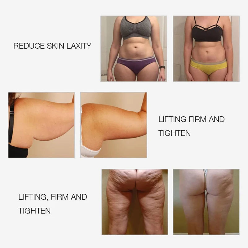 EMS & RF Radio Frequency Body Slimming Machine Fat Burner Slim Shaping Device LED Light Therapy Lose Weight Cellulite Massager