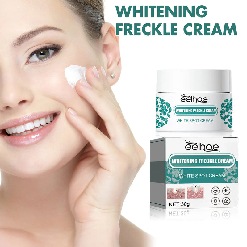 EELHOE Nicotinamide Freckles Cream Moisturizing Face Lightening Repair Skin Care Melasma Remover Pigmentation Removal Cream 30g