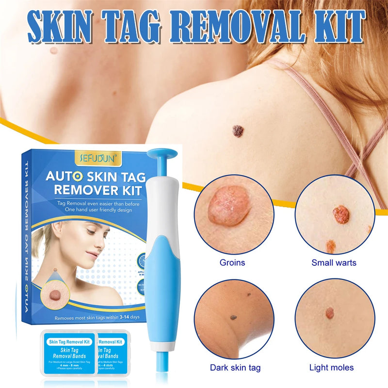 2 IN 1 Auto Micro Skin Tag Remover Device Standard And Micro Skin Tag Removal Kit Adult Mole Wart Remover Face Care Beauty Tools