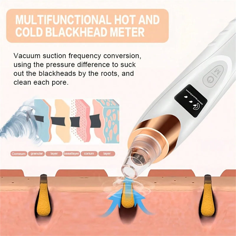 Electric Facial Skin Care Pore Removal Cleanser Vacuum Acne Removal ,Women Blackhead Remover Pore Vacuum,Facial Pore Cleaner