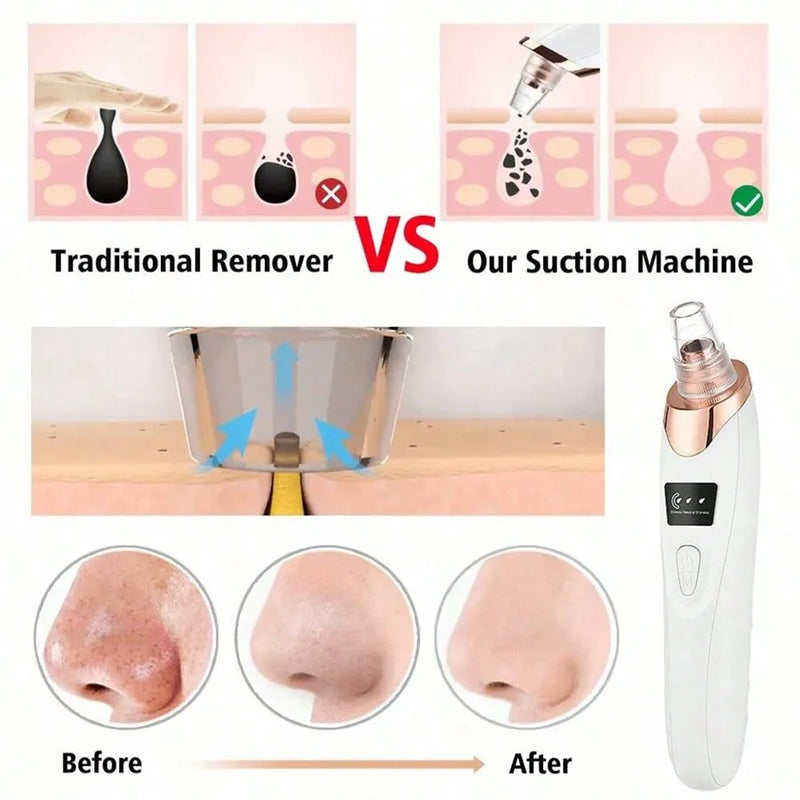 Electric Facial Skin Care Pore Removal Cleanser Vacuum Acne Removal ,Women Blackhead Remover Pore Vacuum,Facial Pore Cleaner